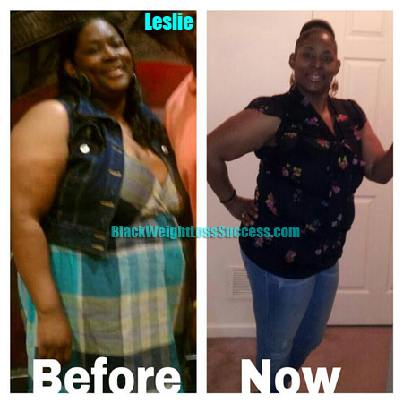 Leslie weight loss before after