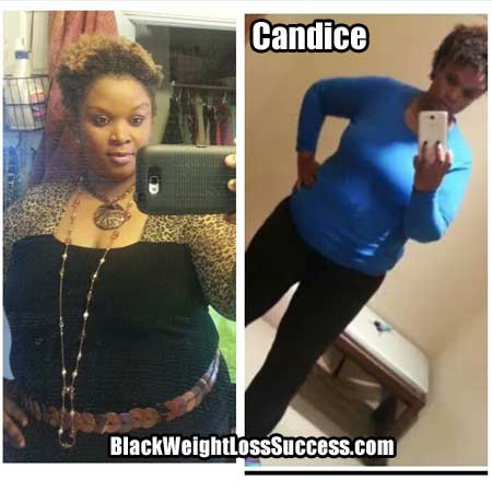 Candice before and after weight loss