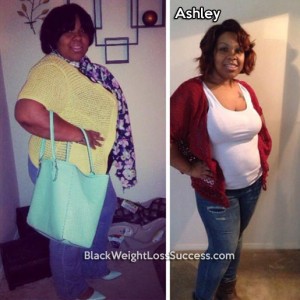 Ashley lost 123 pounds with surgery. | Black Weight Loss Success