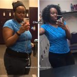 cherise before and after