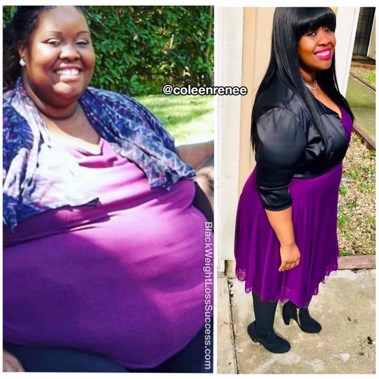 Coleen lost 336 pounds | Black Weight Loss Success