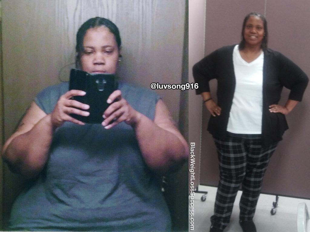 Song lost 157 pounds | Black Weight Loss Success