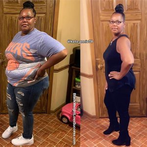 Annie lost 131 pounds | Black Weight Loss Success