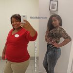 Sheila lost 103 pounds