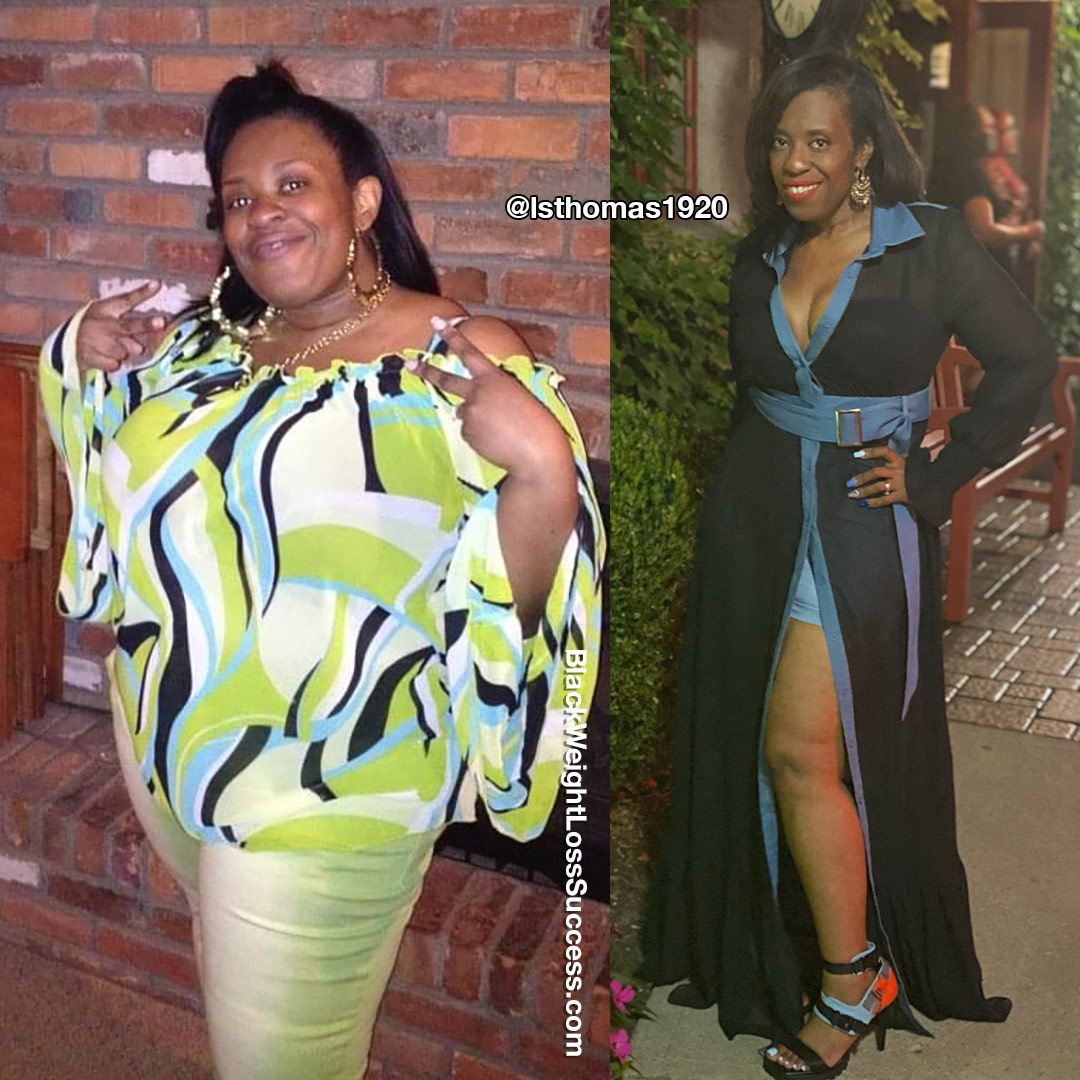 Lynese before and after weight loss