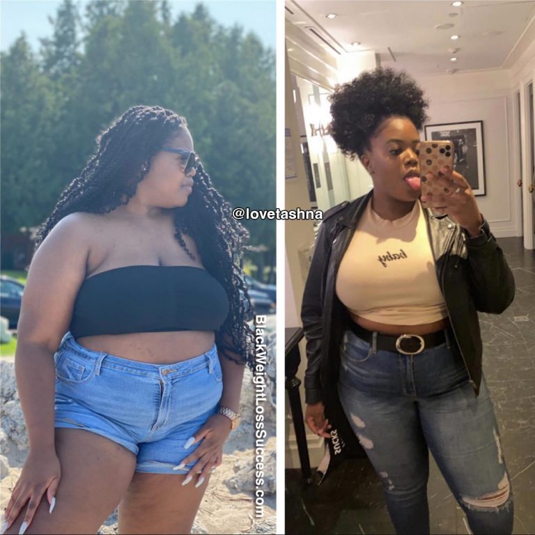 Tashna’s Weight Loss Journey 