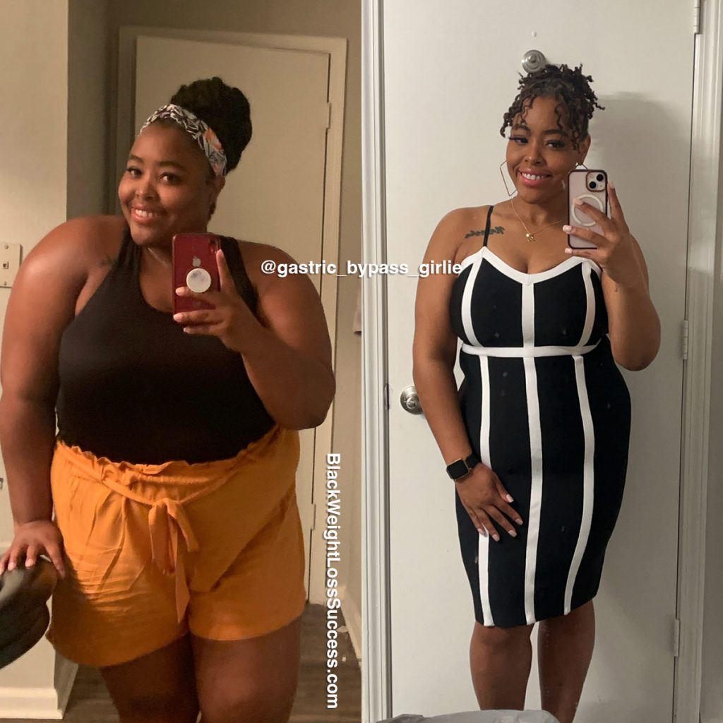 Before and After Photos | Black Weight Loss Success