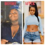 Shanay Alexis before and after