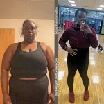 Deja before and after gastric sleeve