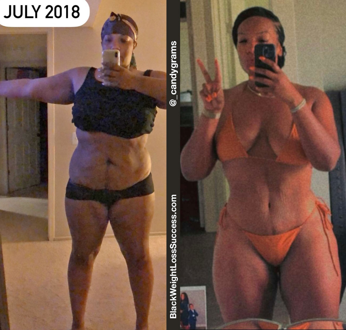 Before and after weight loss