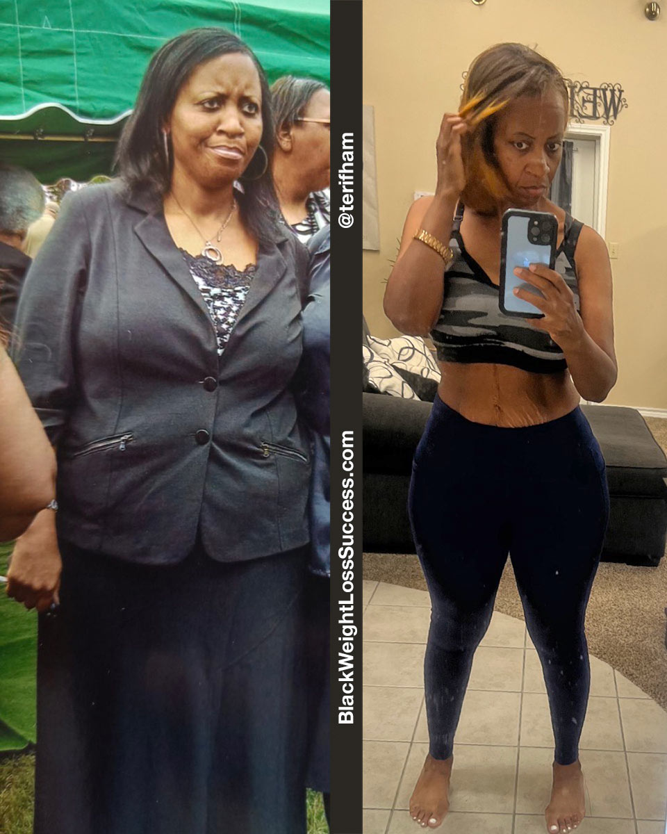 Teri’ misplaced 116 kilos | Black Weight Loss Success