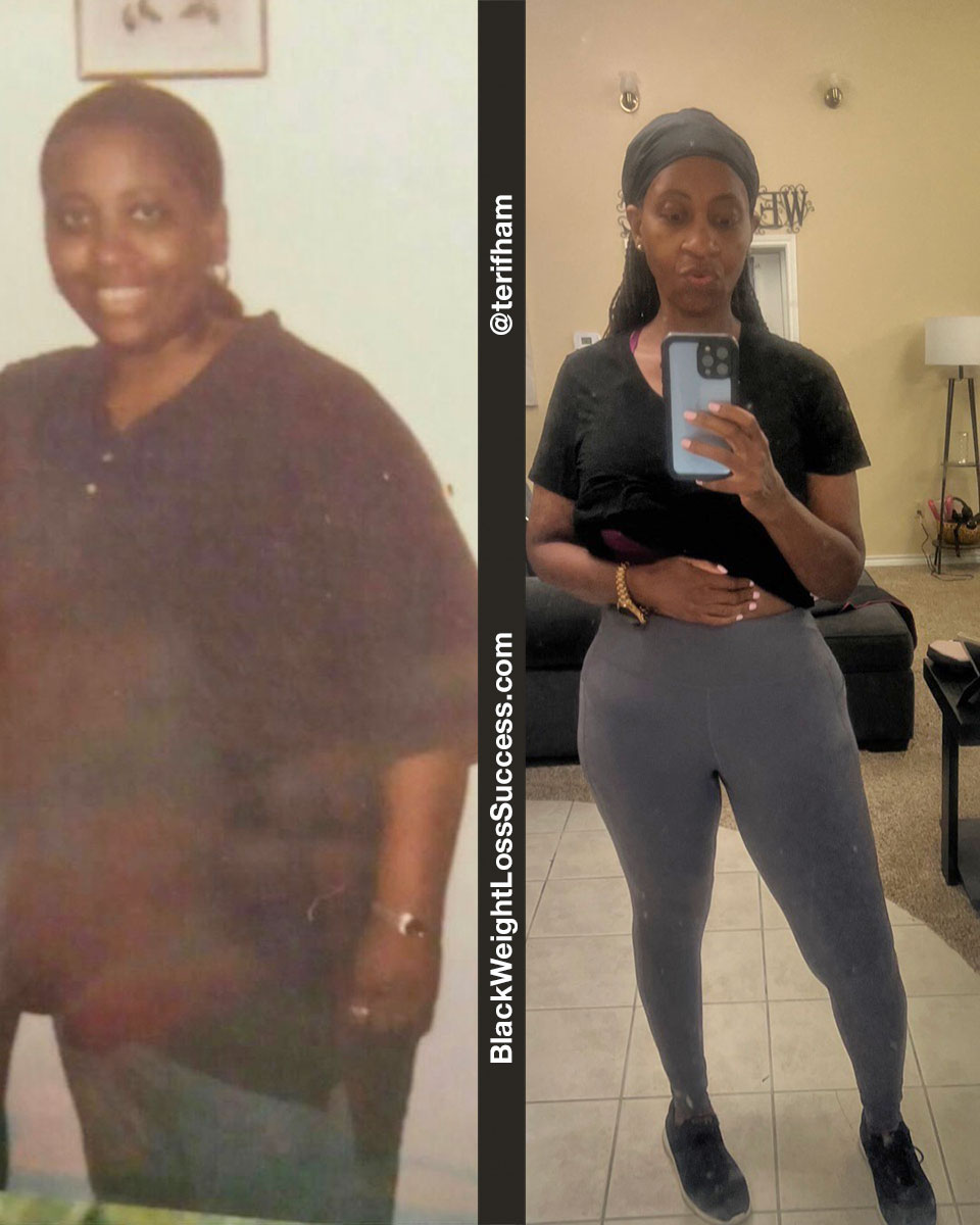 Teri before and after weight loss