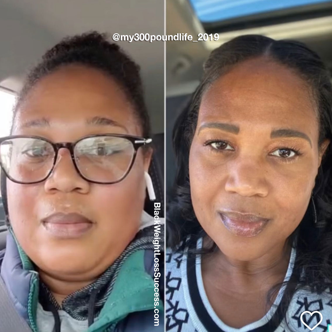 Elisha face to face after weight loss