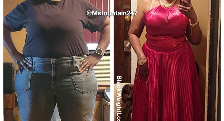 Consuella before and after weight loss